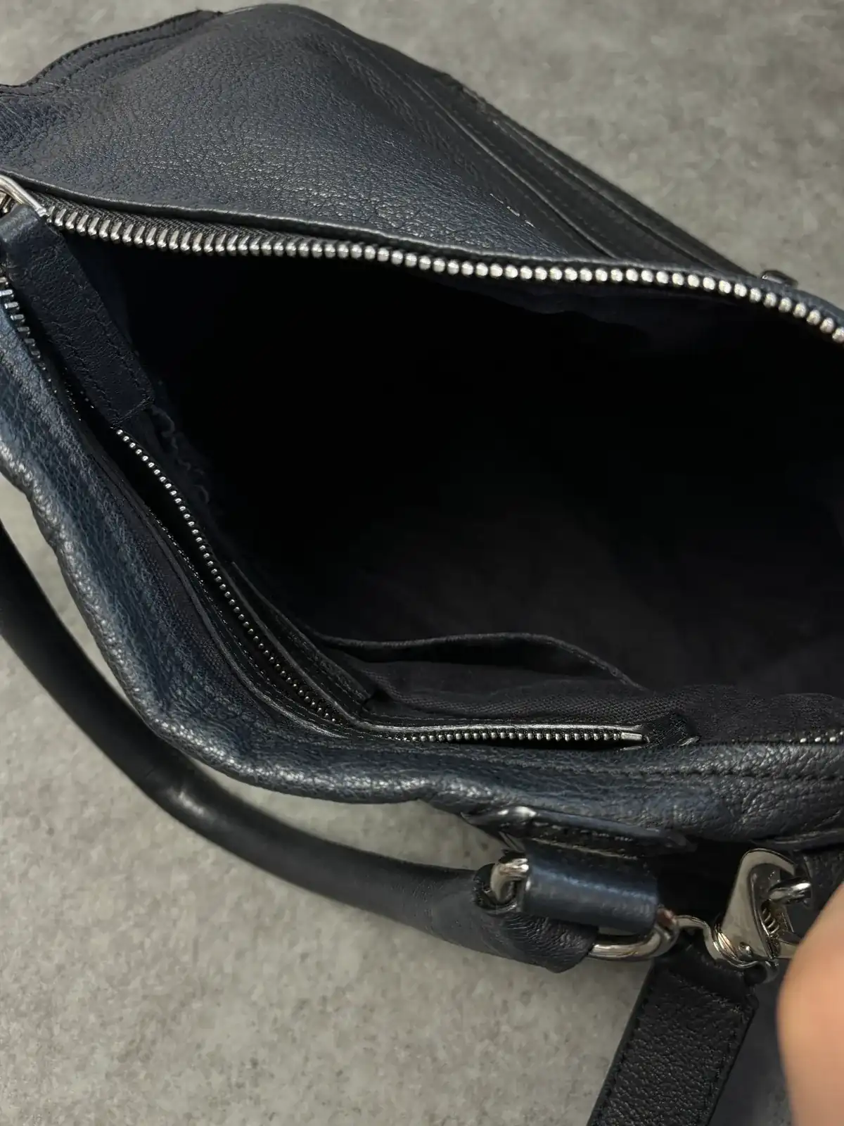 지방시 전체클리닝, 영양 after 11