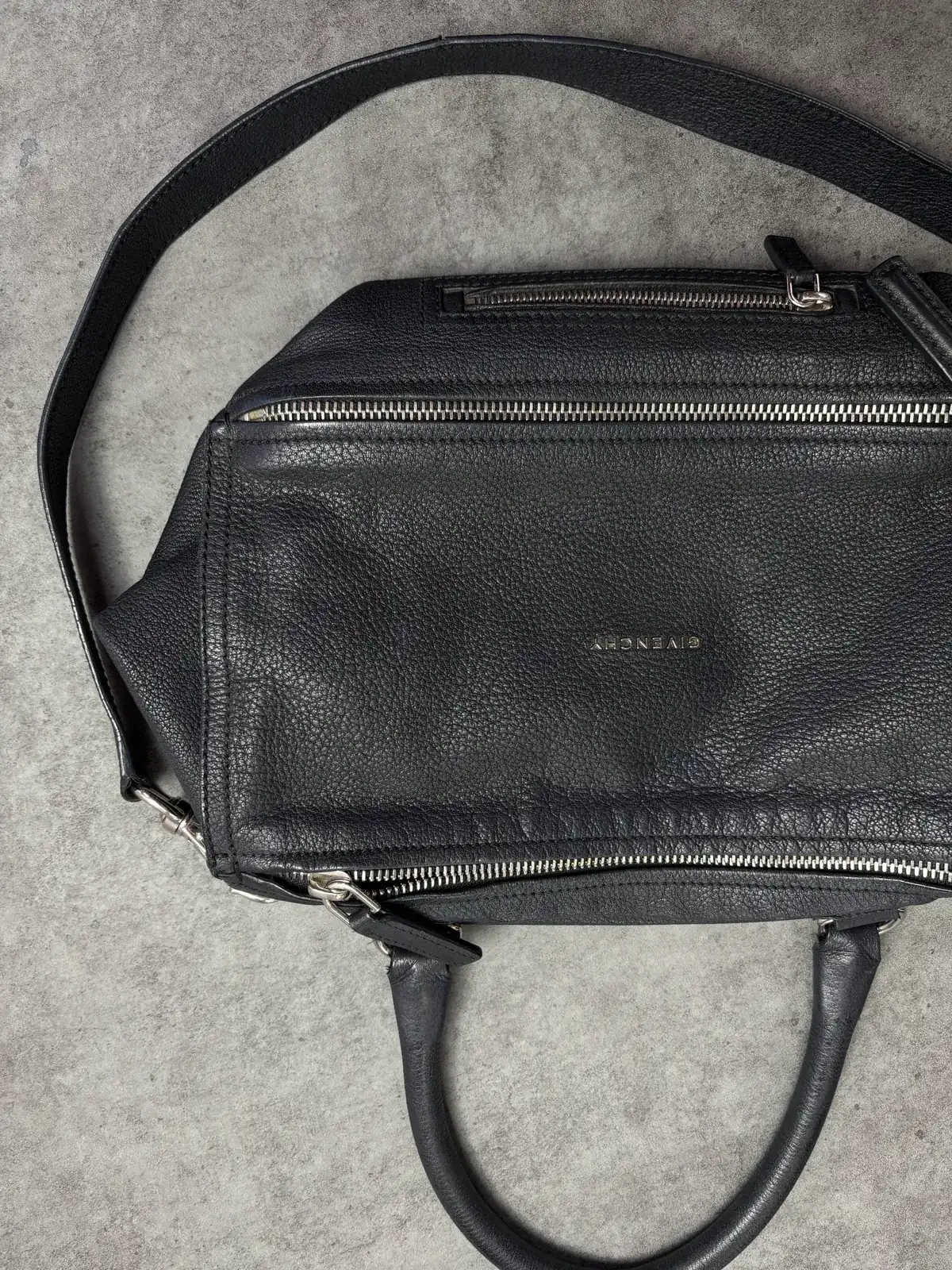 지방시 전체클리닝, 영양 before 3