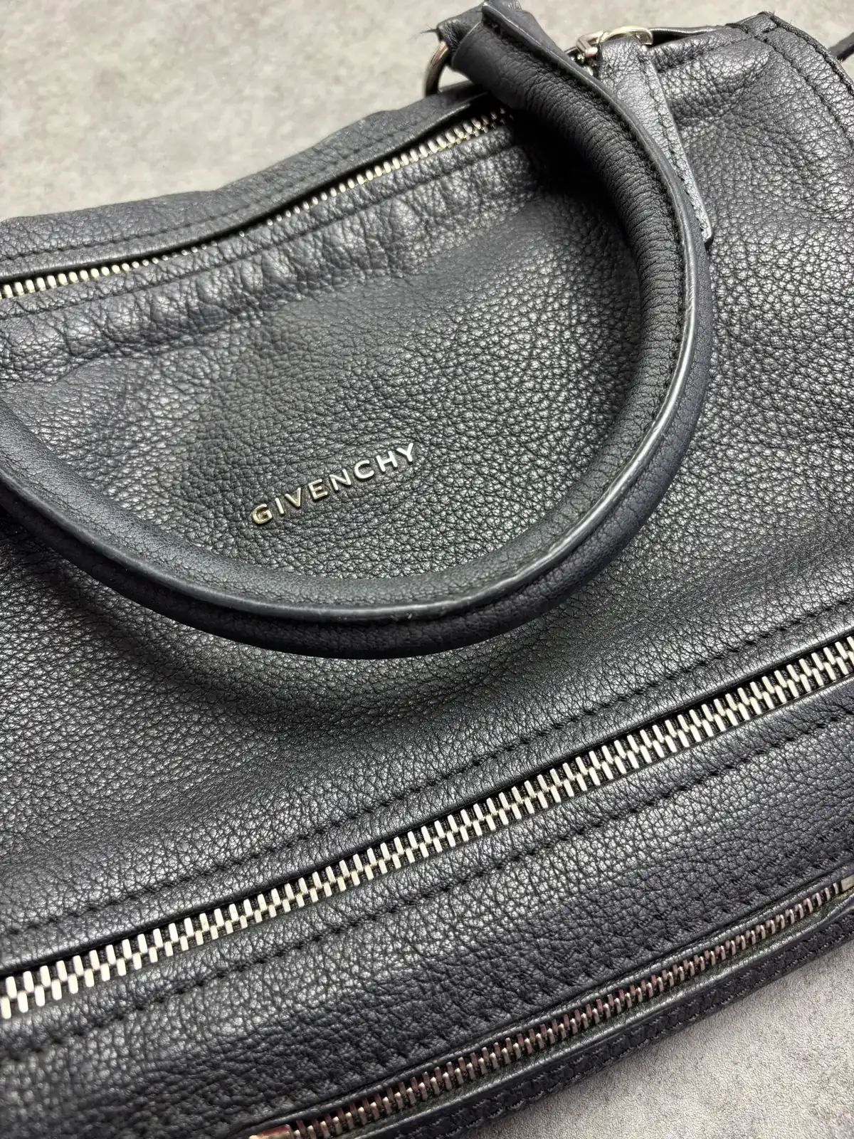 지방시 전체클리닝, 영양 before 4